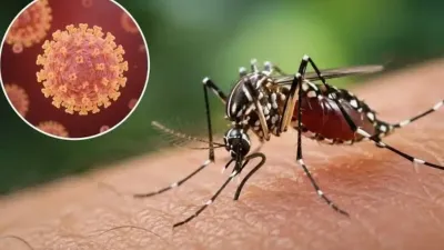 Risiko Zika di Bali Jadi Sorotan, Kemenkes Belum Temukan Kasus