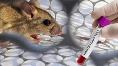 Hantavirus Terdeteksi di Jawa Timur, Pasien Sudah Sembuh